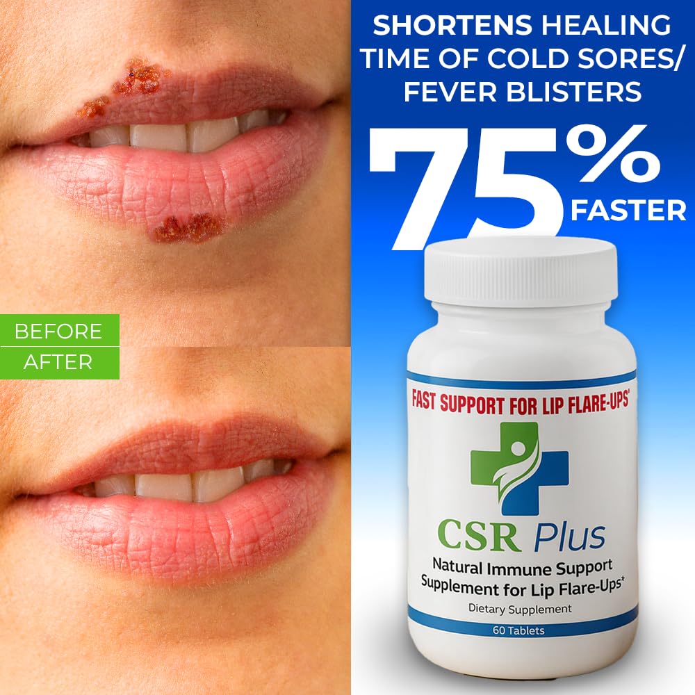 Natural Immune Support Supplement F945